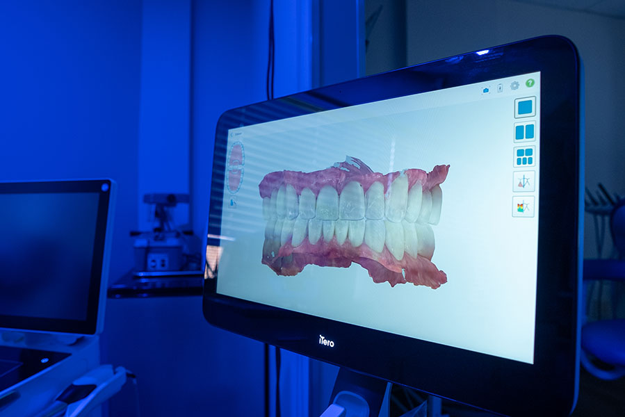SmilesCrafters | Emergency Treatment, All-On-X and Dental Bridges