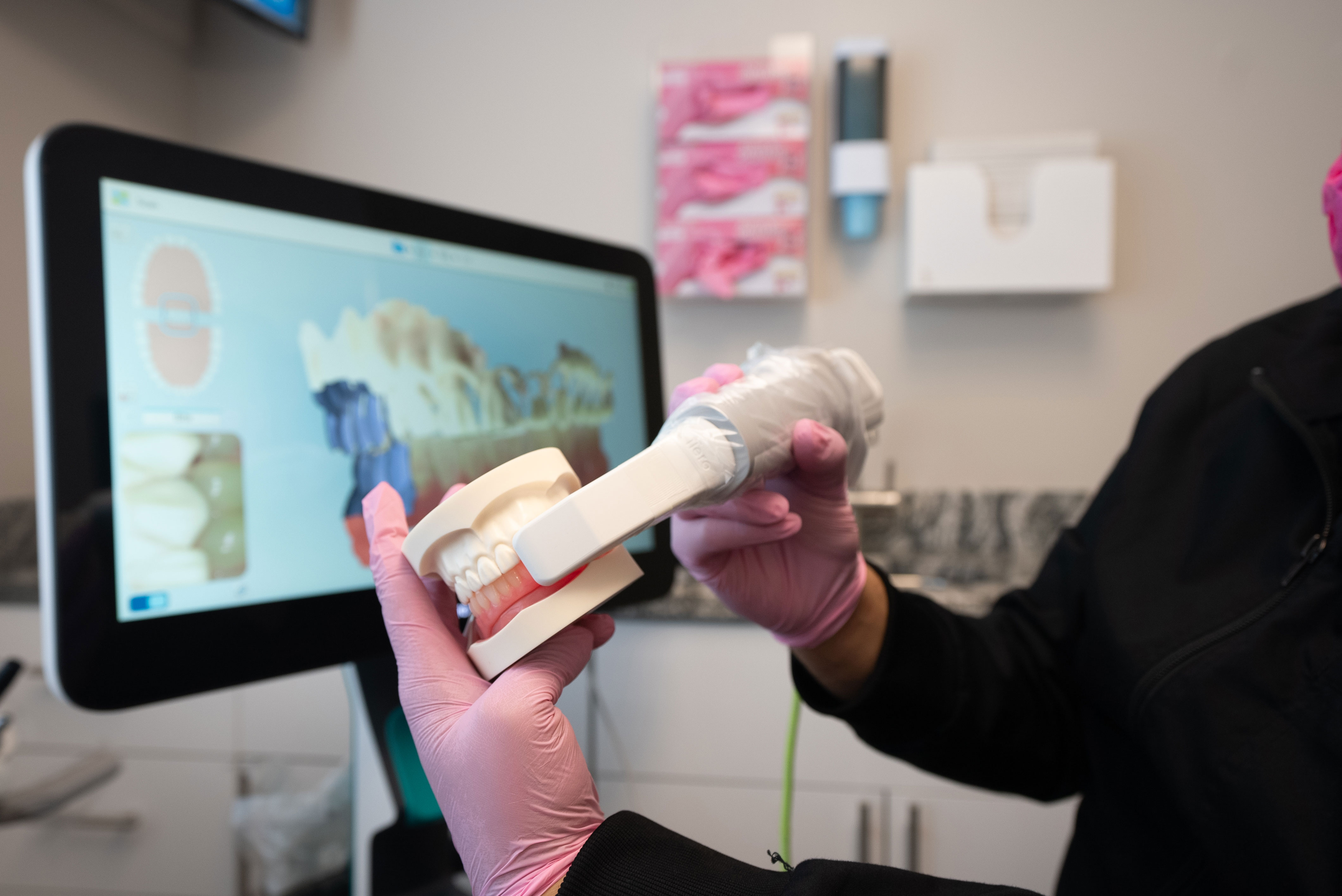 SmilesCrafters | All-on-6®, Preventative Program and Extractions