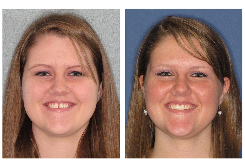 SmilesCrafters